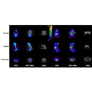 MRI vložky do systémů IRIS PET