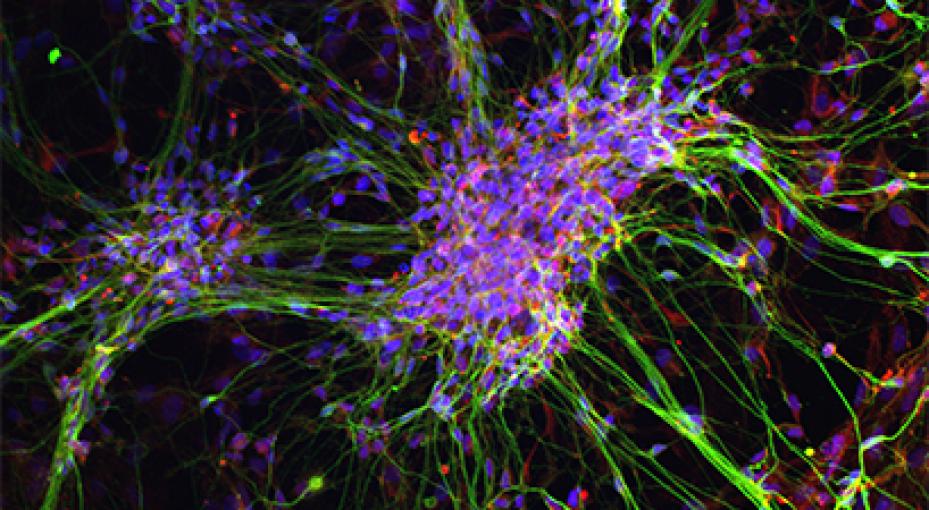 neurons differenitated from neural crest stem cells