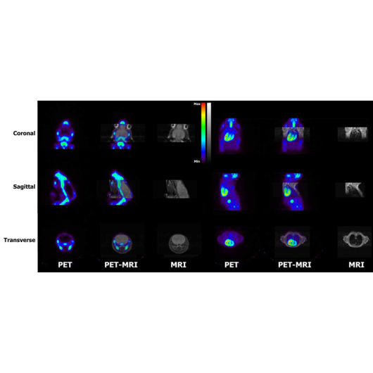 PETMRI_Results_s